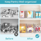 Vtopmart 2Pack Large Stackable Kitchen Pantry Storage Drawers, Clear Organizer Bins with Handles, Acrylic Drawer Organizers for Kitchen Pantry, Bathroom Undersink, Cabinet Organization and Storage